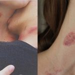 Cô gái 16 tuổi ra đi mãi mãi chỉ vì nụ hôn ‘đánh dấu quyền sở hữu’ của bạn trai